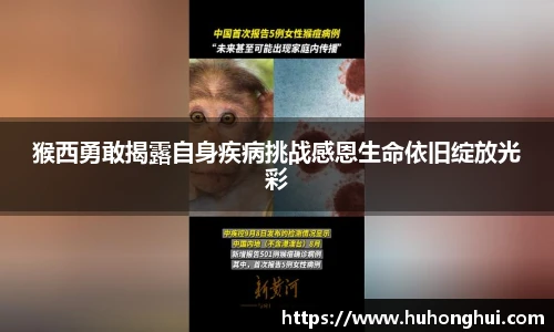 猴西勇敢揭露自身疾病挑战感恩生命依旧绽放光彩